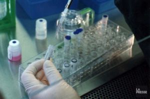 Une étude fédérale sous-estimerait le taux d'hépatite B et C